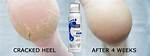 Does Footlogix Really Work?