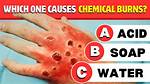 Does Fumaric Acid Burn?