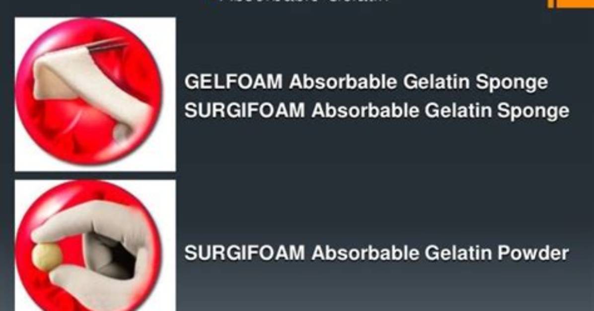 Does Gelfoam Dissolve