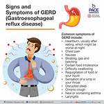 Does Gerd Cause Nausea?