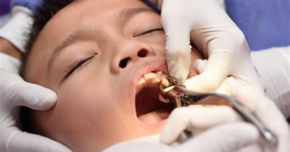 Does Getting S Tooth Pulled Hurt?