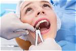 Does Getting Two Teeth Pulled Hurt?