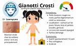 Does Gianotti Crosti Itch?