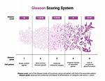Does Gleason 6 Progress?