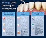 Does Gum Clean Teeth?