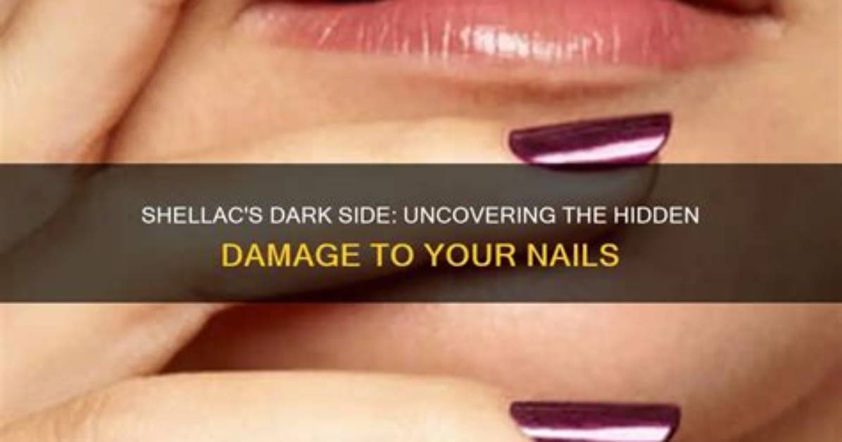 Does Having Shellac Damage Your Nails?
