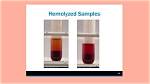 Does Hemolyzed Mean Intact?