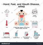 Does Hfmd Affect Sleep