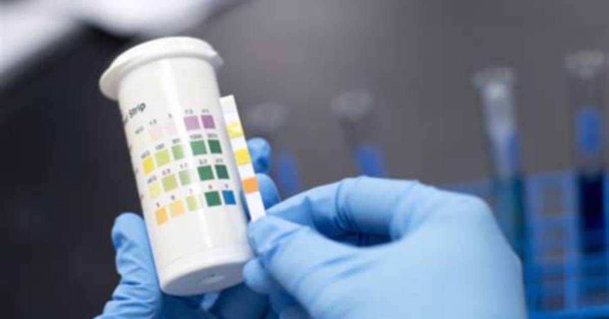 Does Hillside Drug Test?