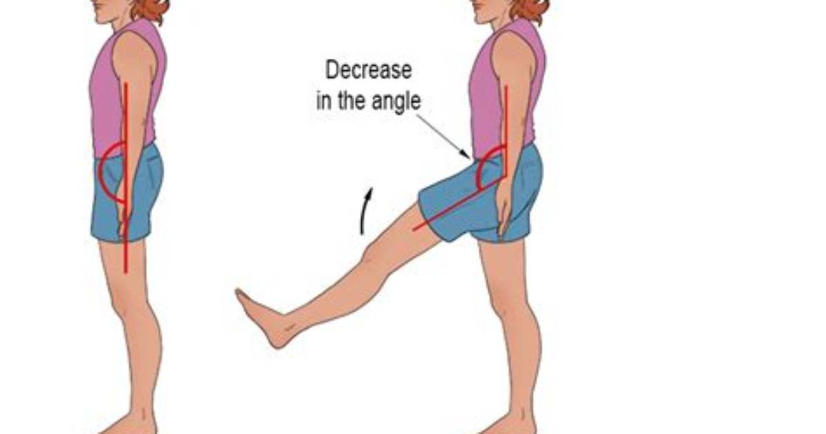 Does Hip Flexion Occur?