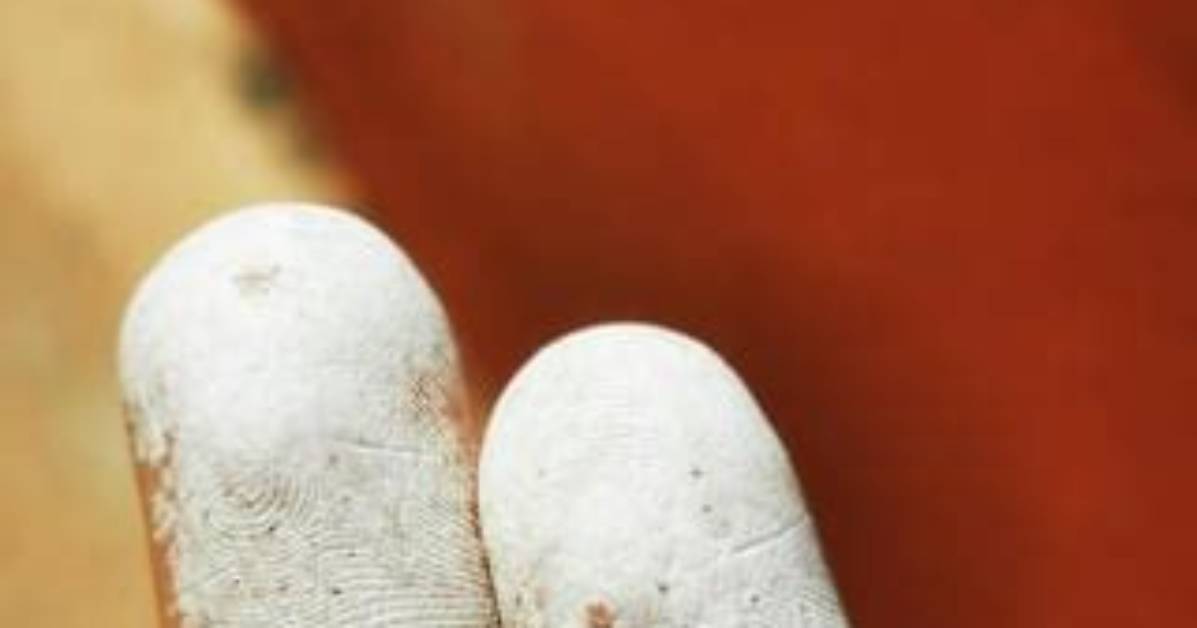 Does Hydrogen Peroxide Burn?