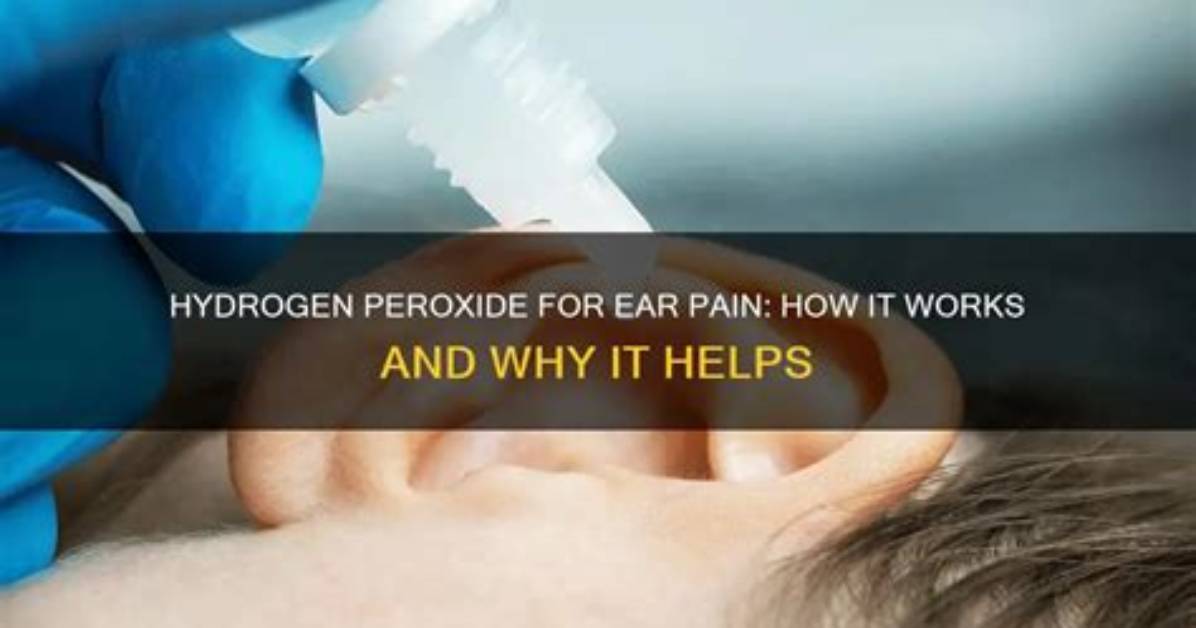 Does Hydrogen Peroxide Help Earache?