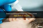Does Hydrogen Peroxide Help Earache?