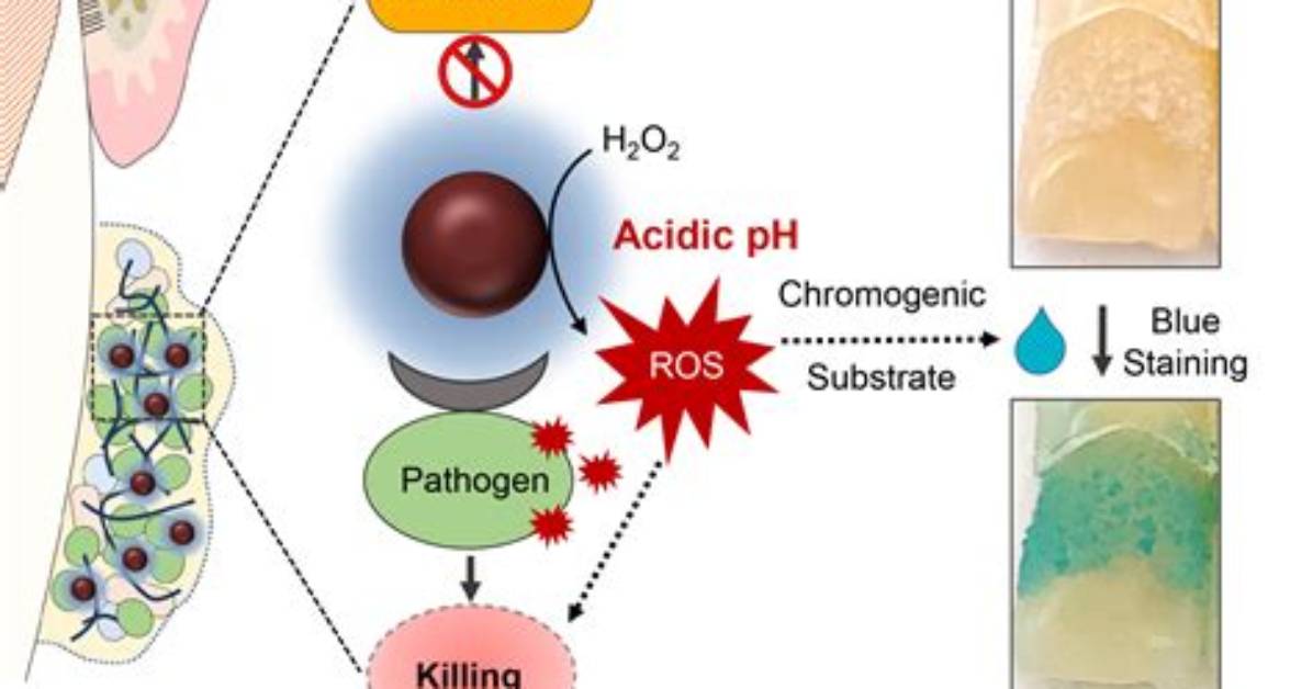 Does Hydrogen Peroxide Kill Bacteria?