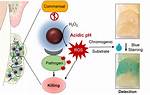 Does Hydrogen Peroxide Kill Bacteria?