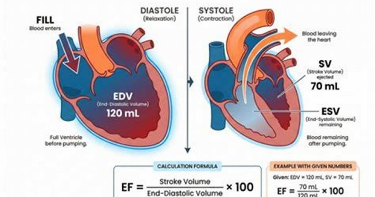 Does Icd Improve Ejection Fraction?
