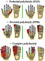 Does Inbreeding Cause Polydactyly?