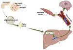 Does Insulin Increase Ketogenesis?