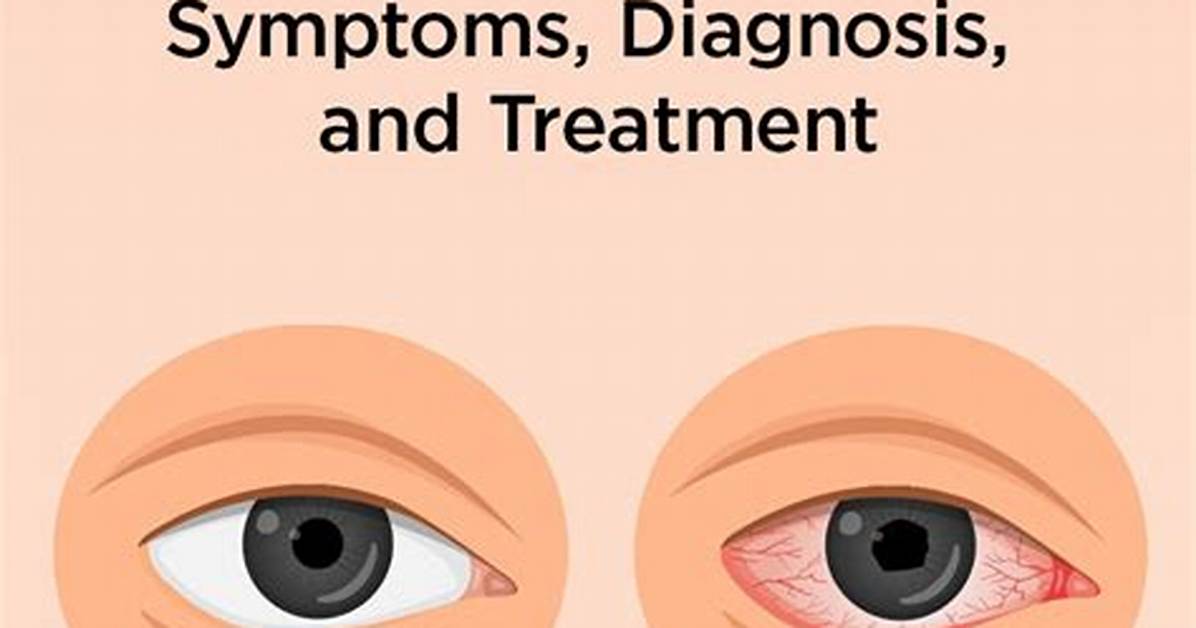 Does Iritis Cause Headaches?