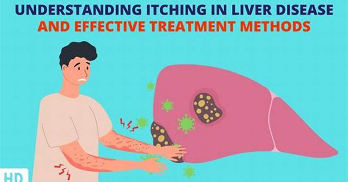 Does Itching Mean Liver Problems?
