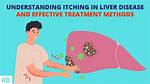 Does Itching Mean Liver Problems?