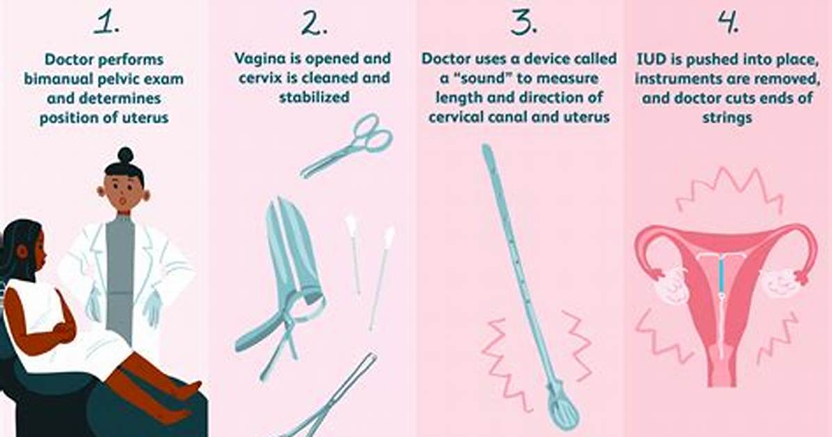 Does Iud Insertion Hurt?