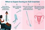 Does Iud Insertion Hurt?