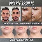 Does Jaw Shaper Work?