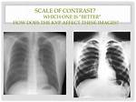 Does kVp Affect Contrast