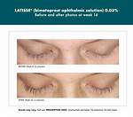 Does Latisse Stop Working?