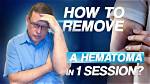 Does Massaging a Hematoma Help?
