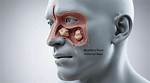 Does Maxillary Sinus Surgery Hurt?
