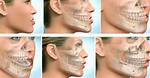 Does Maxillofacial Surgery Hurt?