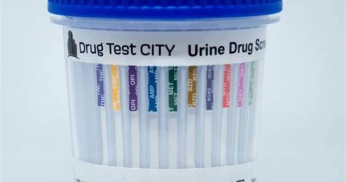 Does Mckesson Do Drug Test?