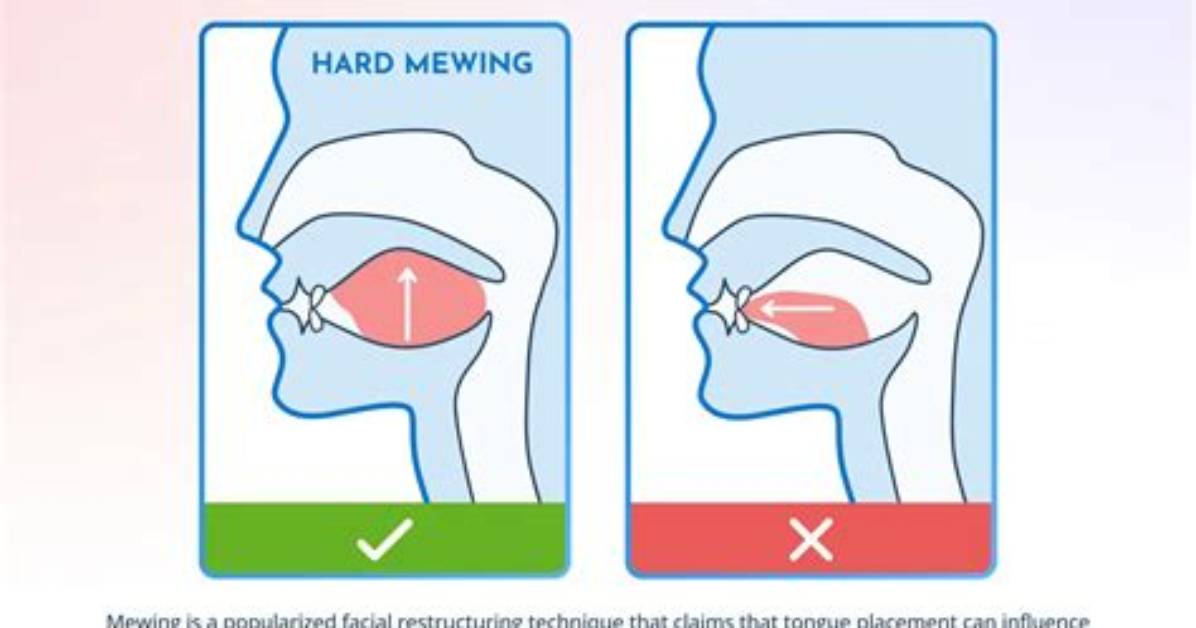 Does Mewing Do Anything?