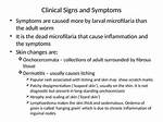 Does Microfilaria Cause Itching?