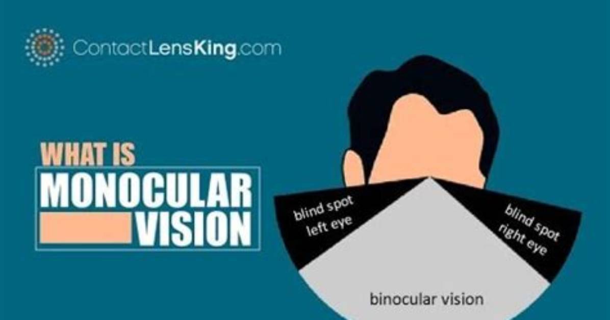 Does Monocular Vision Affect Balance?