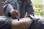 Does Moxibustion Really Work?