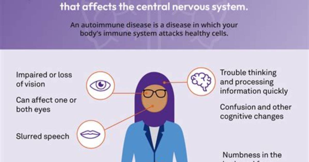 Does Ms Cause Drooling?