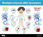 Does Ms Cause Paralysis?