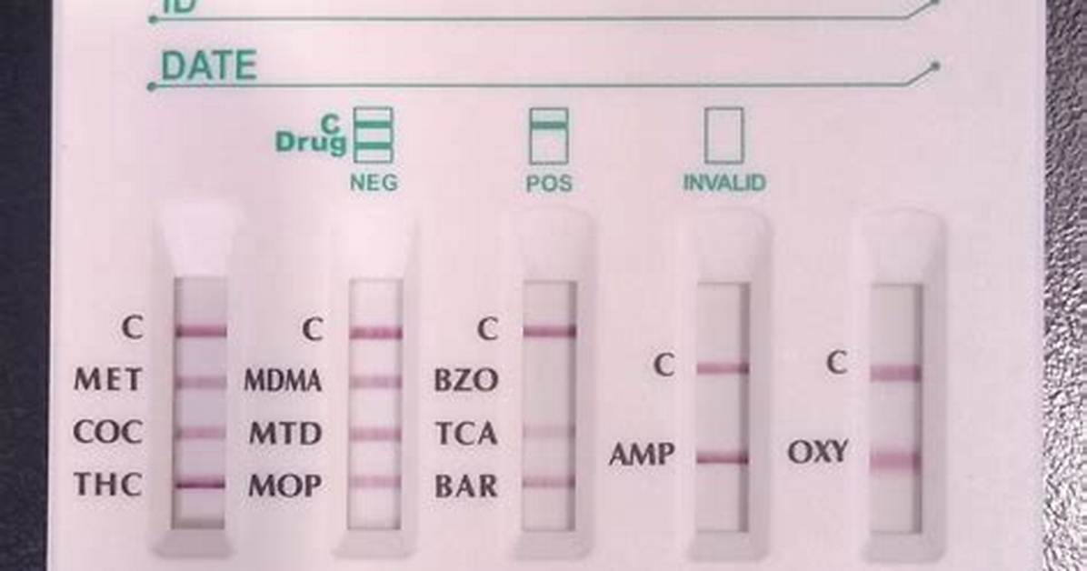 Does Mti Drug Test?
