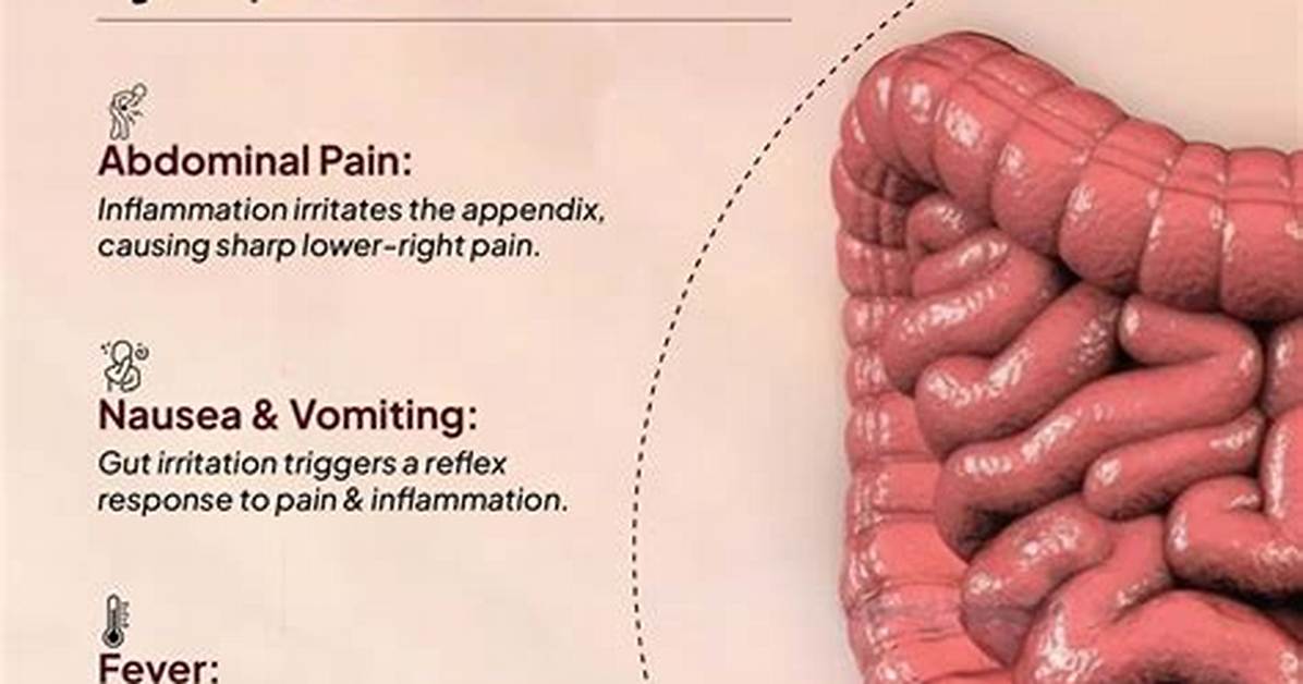 Does My Appendix Hurt?