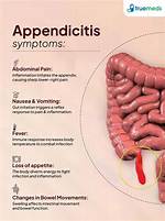 Does My Appendix Hurt?