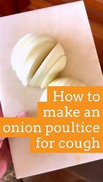 Does Onion Poultice Work?