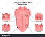 Does Papillae Grow Back?