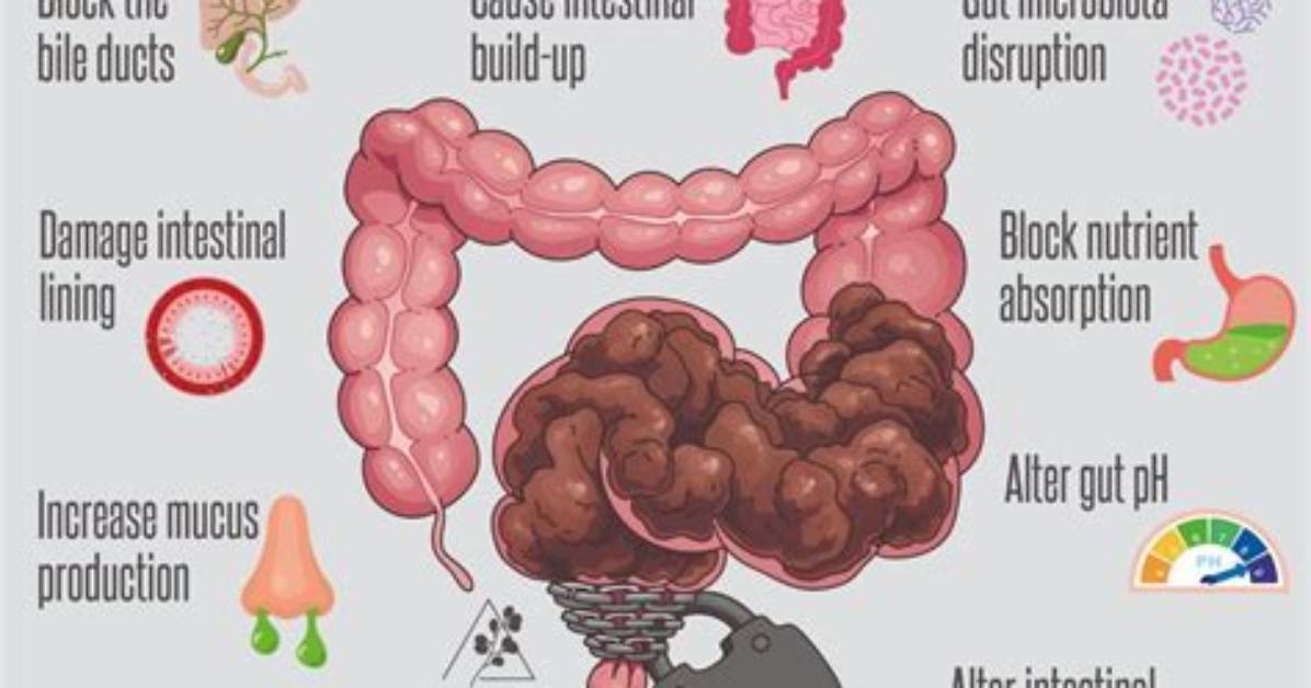 Does Parasites Cause Constipation?