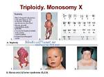 Does Pgs Test for Triploidy?