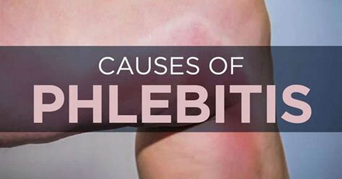 Does Phlebitis Get Better?