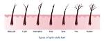 Does Plaiting Hair Cause Split Ends?