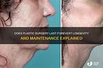 Does Plastic Surgery Last Forever?